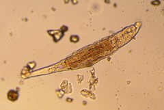 Bdelloidea