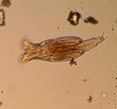 Bdelloidea