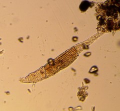 Bdelloidea