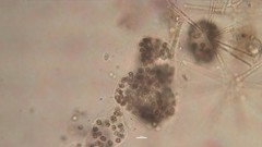 Microcystis wesenbergii