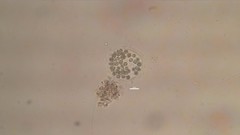 Microcystis wesenbergii