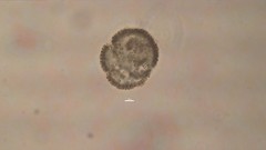 Woronichinia
