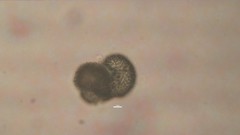 Woronichinia