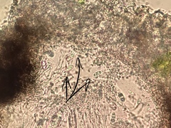 Anisomeridium leucochlorum