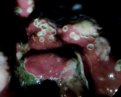 Phymatolithon calcareum