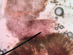 Chaenothecopsis pusiola