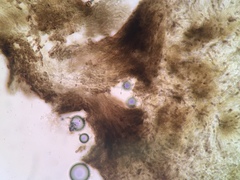 Chaenothecopsis pusiola