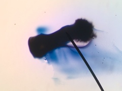 Calicium lenticulare