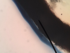 Calicium lenticulare