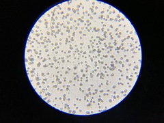 Pseudobaeospora murrillii