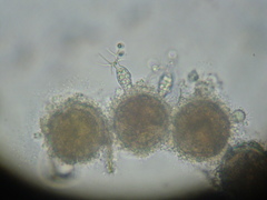 Chytridiomycota