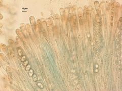 Adelphella babingtonii