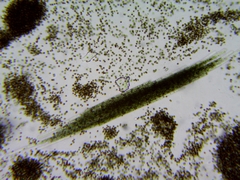 Aphanizomenon flosaquae