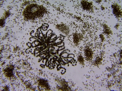 Dolichospermum lemmermannii