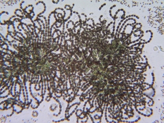 Dolichospermum lemmermannii