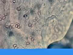 Lycoperdon dermoxanthum