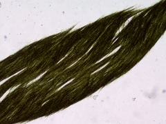 Aphanizomenon flosaquae