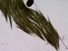 Aphanizomenon flosaquae