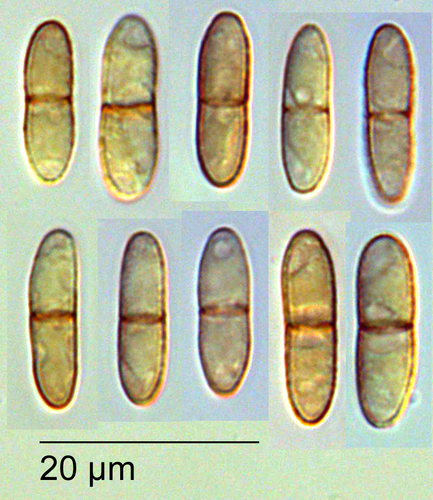 Ascochyta hordei
