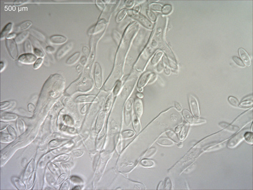 Representative image of Dothideales