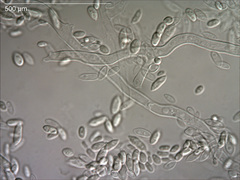 Aureobasidium pullulans