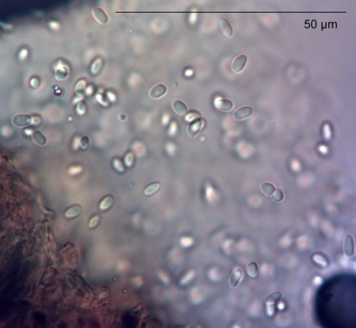 Boeremia hedericola