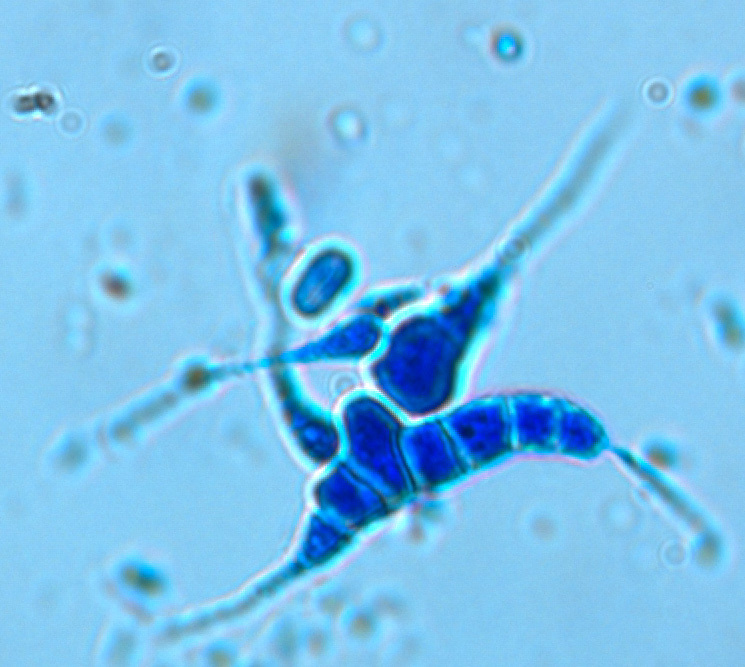 Campylospora