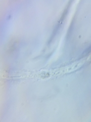 Dacrymyces minor