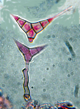 Diplocladiella