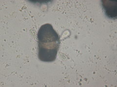 Chytridiomycota