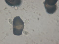 Chytridiomycota