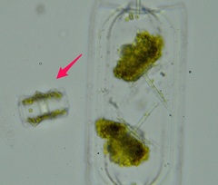 Asteromphalus heptactis