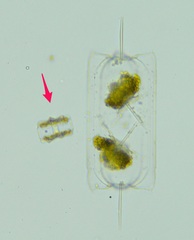 Asteromphalus heptactis