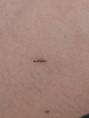 Pseudomyrmex oculatus