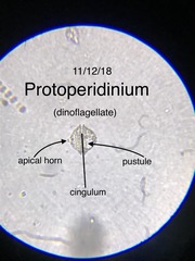 Protoperidinium
