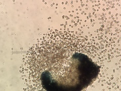 Lichenoconium pyxidatae