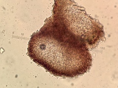 Tremella cladoniae
