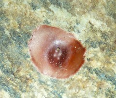 Phrurolithidae
