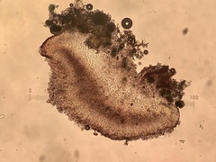 Bacidia diffracta
