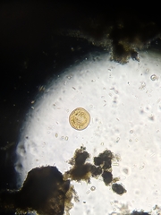 Balantidium
