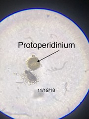 Protoperidinium