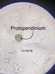 Protoperidinium