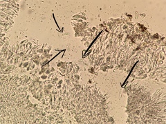 Bacidia fuscoviridis