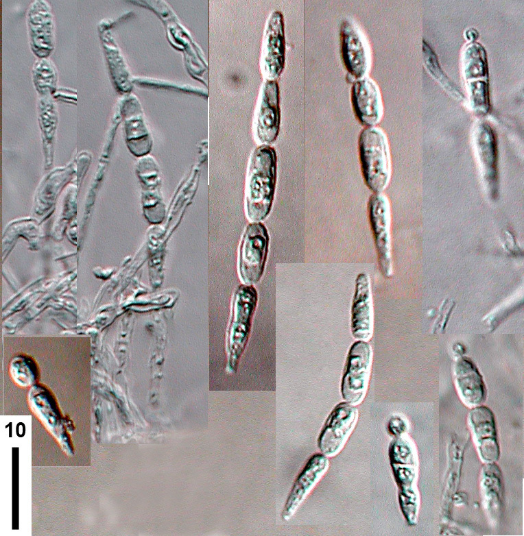 Isthmolongispora