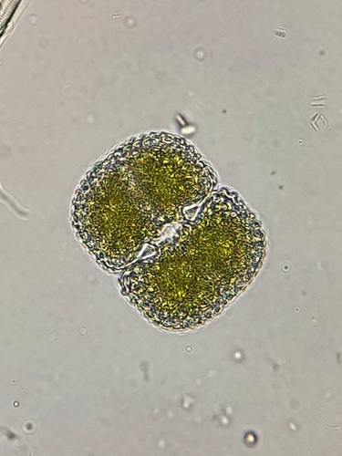 Cosmarium quadrum
