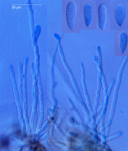 Ramularia simplex