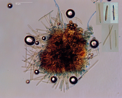 Pseudocercospora nogalesii