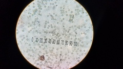 Lycoperdon fuligineum