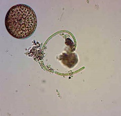 Anabaena