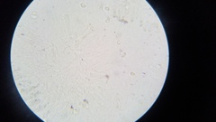 Zhuliangomyces illinitus